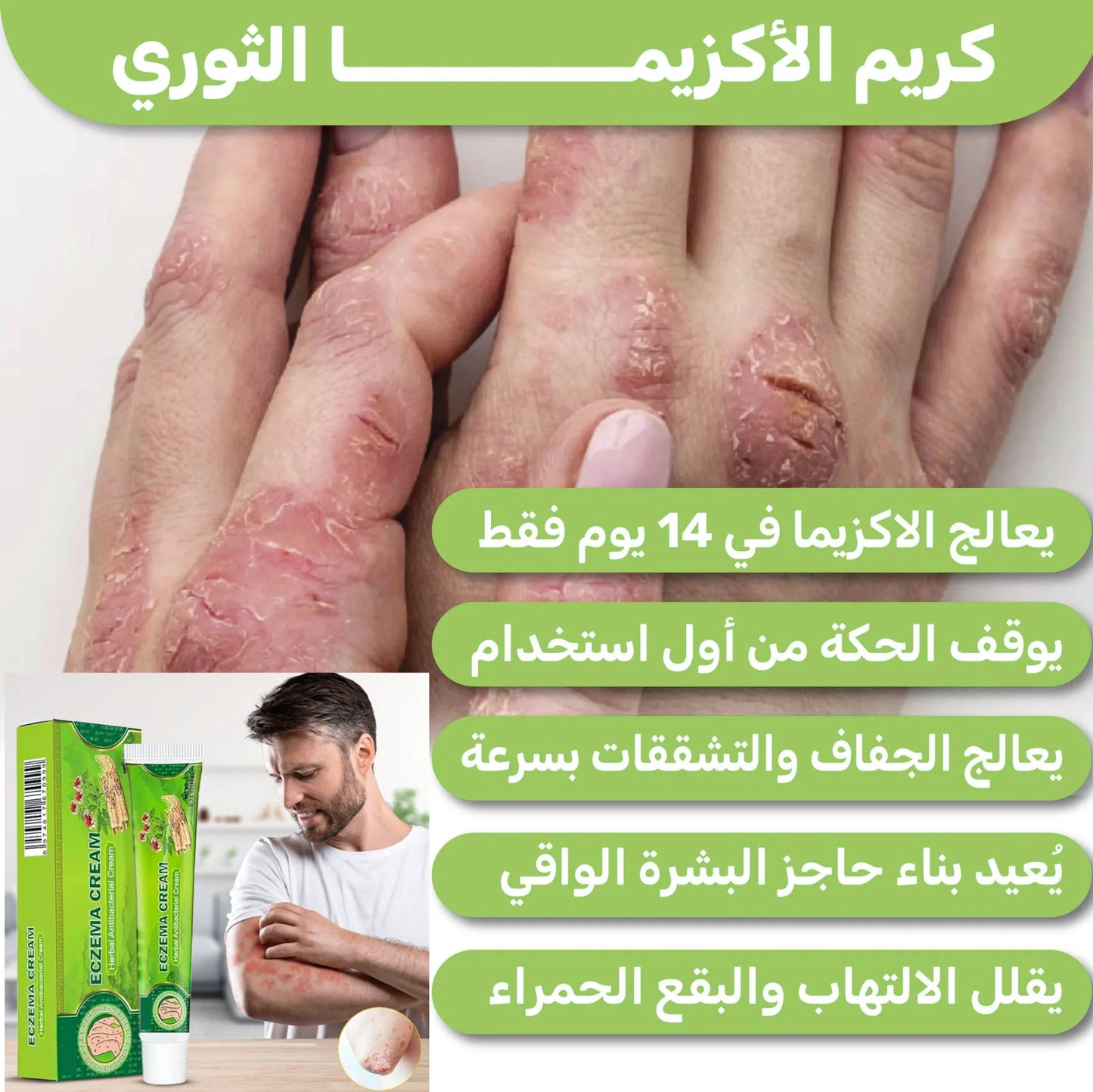 كريم علاج الاكزيما